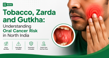 Tobacco, Zarda and Gutkha: Understanding Oral Cancer Risk in North India 