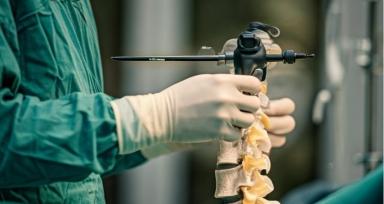 Endoscopic Spine Surgery vs Traditional Spine Surgery