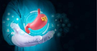 HIPEC for Rare Cancers