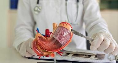 How to Choose a HIPEC Surgeon