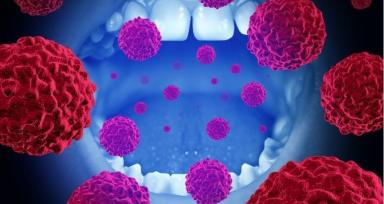 Seven Sites of Mouth Cancer Explained Simply