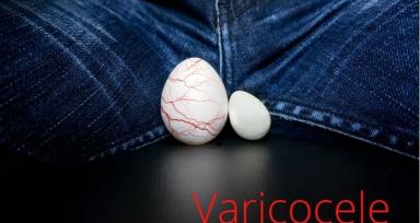 What Does Varicocele Embolization Feel Like-Real Patient Experience Explained
