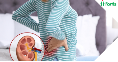 गर्मी में गुर्दे की पथरी (Kidney Stone) 