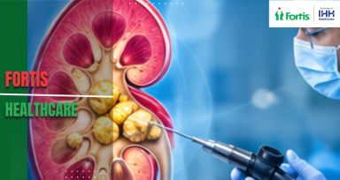 Kidney Specialist Doctor