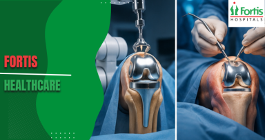 Robotic vs Non-Robotic Knee Replacement