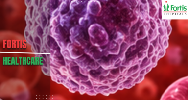 Best Cancer Hospital in Delhi 