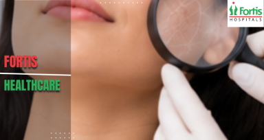 Dermatologist in Chandigarh 