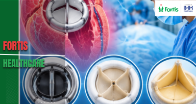 Heart Valve Replacement in India