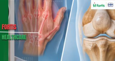 Rheumatoid Arthritis