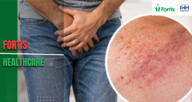 Male Intimate Itching