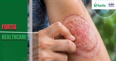 Monsoon Skin Infections