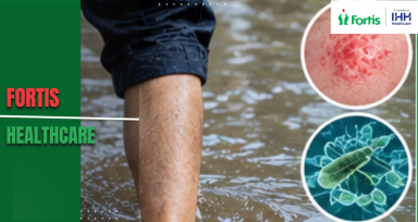 Floodwater Exposure in Bengaluru