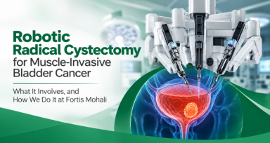 Robotic Bladder Cancer Surgery Infographic