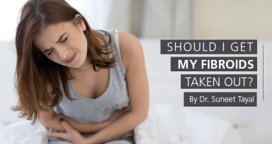 Should I Get My Fibroids Taken Out?
