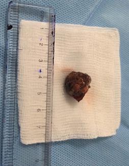 piece of a betel nut 