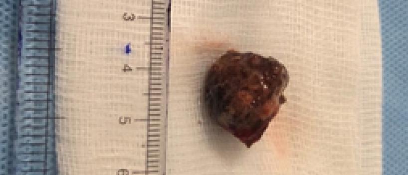 piece of a betel nut 