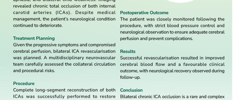 CHRONIC TOTAL - OCCLUSIONS OF BOTH ICAS: A RARE CHALLENGE. A SUCCESSFUL REVASCULARISATION