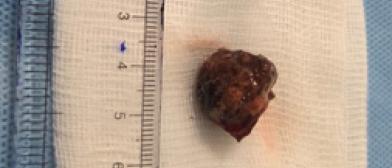 piece of a betel nut 