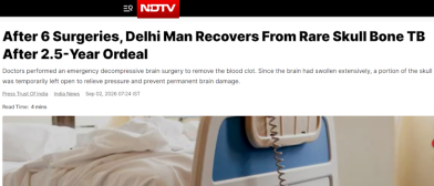 After 6 Surgeries Delhi Man Recovers From Rare Skull Bone TB After 2 and half Year 