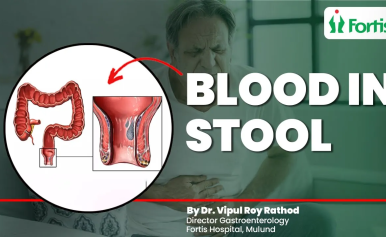 Blood In Stool Causes and Treatment 