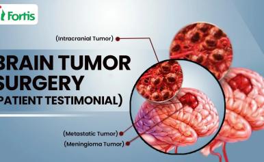 Brain Tumor Surgery