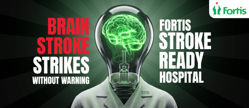 Brain Stroke
