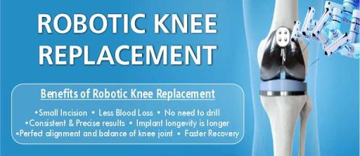Robotic Knee Replacement