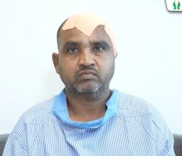 best neurosurgeon in greater noida