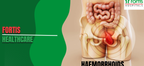 Haemorrhoids