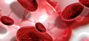 High Blood Cholesterol 