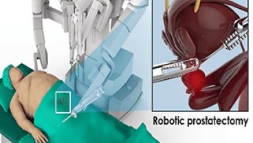 surgery oncology