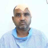 best neurosurgeon in greater noida