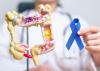 Colon Rectal Cancer