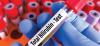 Bilirubin Test