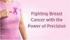 Breast Cancer Radiation