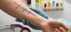 Allergy skin tests