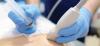  Breast biopsy