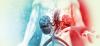 Carotid Angioplasty and Stenting