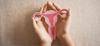 Cervical Cancer
