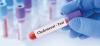 Cholesterol test