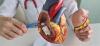 Transcatheter Aortic Valve Replacement