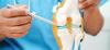 Unicondylar Knee Replacement
