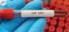 C-reactive protein test