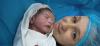 C-section