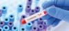 Creatinine test