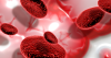 High Blood Cholesterol 