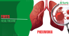 Pneumonia 